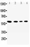 Cell adhesion molecule 1 antibody, PA2294, Boster Biological Technology, Western Blot image 