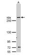 FAS antibody, PA5-22111, Invitrogen Antibodies, Western Blot image 