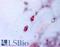 Aggrecan antibody, LS-A1556, Lifespan Biosciences, Immunohistochemistry paraffin image 