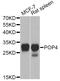 POP4 Homolog, Ribonuclease P/MRP Subunit antibody, A12563, ABclonal Technology, Western Blot image 