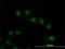 VRK Serine/Threonine Kinase 2 antibody, H00007444-M01, Novus Biologicals, Immunocytochemistry image 