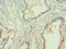 SAP130 antibody, LS-C377382, Lifespan Biosciences, Immunohistochemistry paraffin image 