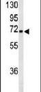 Gamma-Aminobutyric Acid Type A Receptor Alpha4 Subunit antibody, PA5-26306, Invitrogen Antibodies, Western Blot image 