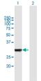 Interleukin 1 Receptor Associated Kinase 1 Binding Protein 1 antibody, H00134728-B01P, Novus Biologicals, Western Blot image 