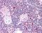 Autoimmune Regulator antibody, orb87567, Biorbyt, Immunohistochemistry paraffin image 