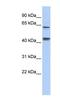 Kelch Like Family Member 8 antibody, NBP1-80347, Novus Biologicals, Western Blot image 