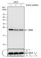 Superoxide Dismutase 2 antibody, GTX630559, GeneTex, Western Blot image 