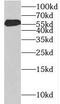 Kelch Domain Containing 4 antibody, FNab04607, FineTest, Western Blot image 