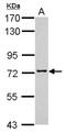 Transmembrane And Coiled-Coil Domains 3 antibody, NBP2-20660, Novus Biologicals, Western Blot image 