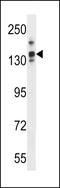 Capping Protein Regulator And Myosin 1 Linker 1 antibody, LS-C158071, Lifespan Biosciences, Western Blot image 