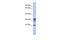 Phosphomannomutase 1 antibody, A09193, Boster Biological Technology, Western Blot image 