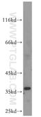 Diacylglycerol O-acyltransferase candidate 5 antibody, 19514-1-AP, Proteintech Group, Western Blot image 
