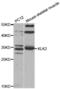 Kallikrein Related Peptidase 2 antibody, abx002174, Abbexa, Western Blot image 