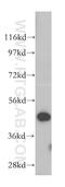 Sorting Nexin 5 antibody, 17918-1-AP, Proteintech Group, Western Blot image 