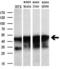 Adipocyte Plasma Membrane Associated Protein antibody, M08954, Boster Biological Technology, Western Blot image 