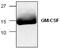 Colony Stimulating Factor 2 antibody, GTX59749, GeneTex, Western Blot image 