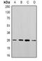 Phosphoglycerate Mutase 2 antibody, abx141442, Abbexa, Western Blot image 