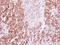 Interleukin-1 family member 7 antibody, GTX108419, GeneTex, Immunohistochemistry paraffin image 