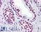 Osf2 antibody, LS-B4293, Lifespan Biosciences, Immunohistochemistry paraffin image 