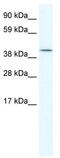 ISL LIM Homeobox 2 antibody, TA329942, Origene, Western Blot image 