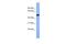 Serine/threonine-protein kinase 25 antibody, A06816, Boster Biological Technology, Western Blot image 