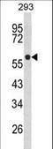 Tryptophan Hydroxylase 1 antibody, LS-C160136, Lifespan Biosciences, Western Blot image 