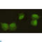 Chromobox 5 antibody, LS-C812997, Lifespan Biosciences, Immunocytochemistry image 