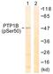 Protein Tyrosine Phosphatase Non-Receptor Type 1 antibody, LS-C199502, Lifespan Biosciences, Western Blot image 