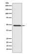 Myogenic Differentiation 1 antibody, M00964-1, Boster Biological Technology, Western Blot image 