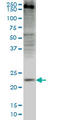 Crystallin Gamma D antibody, LS-C196977, Lifespan Biosciences, Western Blot image 