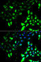 Kinesin Family Member 2B antibody, MBS129722, MyBioSource, Immunofluorescence image 