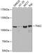 ACK1 antibody, 18-690, ProSci, Western Blot image 