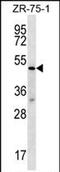 Transducin beta-like protein 2 antibody, PA5-71756, Invitrogen Antibodies, Western Blot image 
