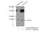 Dynein Light Chain Tctex-Type 1 antibody, 11954-1-AP, Proteintech Group, Immunoprecipitation image 