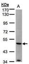 Matrix Metallopeptidase 12 antibody, GTX102928, GeneTex, Western Blot image 