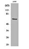 Glutamate-Cysteine Ligase Catalytic Subunit antibody, orb161146, Biorbyt, Western Blot image 