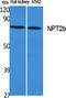 Solute Carrier Family 34 Member 2 antibody, STJ96469, St John