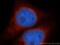 Beta-Carotene Oxygenase 2 antibody, 14324-1-AP, Proteintech Group, Immunofluorescence image 