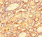 C-X-C Motif Chemokine Ligand 11 antibody, LS-C211275, Lifespan Biosciences, Immunohistochemistry paraffin image 