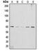 AKT Serine/Threonine Kinase 2 antibody, LS-C351826, Lifespan Biosciences, Western Blot image 