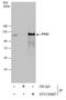 Protein Tyrosine Kinase 2 Beta antibody, GTX130887, GeneTex, Immunoprecipitation image 
