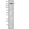 Probable G-protein coupled receptor 179 antibody, abx215687, Abbexa, Western Blot image 