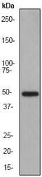 Matrix Metallopeptidase 3 antibody, ab52915, Abcam, Western Blot image 