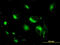 Syntaxin 6 antibody, LS-C133630, Lifespan Biosciences, Immunofluorescence image 