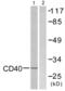CD40 Molecule antibody, abx013215, Abbexa, Western Blot image 