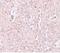 Solute Carrier Family 39 Member 13 antibody, NBP1-76509, Novus Biologicals, Immunohistochemistry paraffin image 