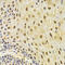 Keratin 8 antibody, LS-C331220, Lifespan Biosciences, Immunohistochemistry paraffin image 