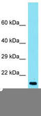 Transmembrane Protein 190 antibody, TA334782, Origene, Western Blot image 