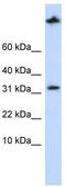 CTD Small Phosphatase 2 antibody, TA342202, Origene, Western Blot image 