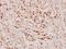 Retinoic Acid Receptor Beta antibody, GTX66626, GeneTex, Immunohistochemistry paraffin image 